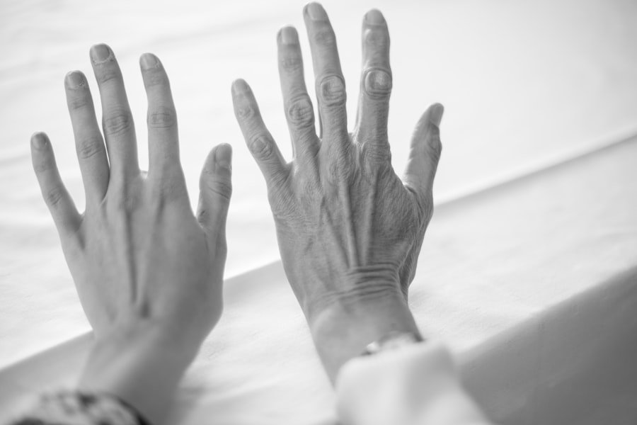 Joints Stiffness