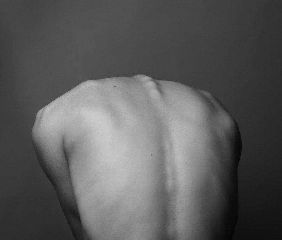 Back Pain