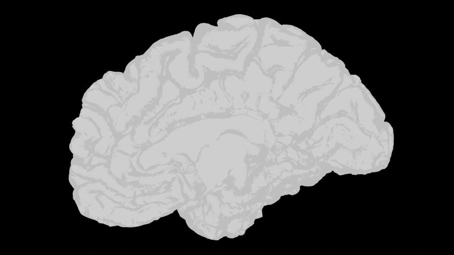 Early Dementia