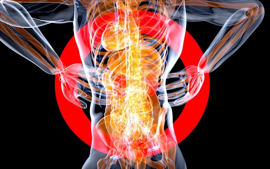 Photo Arthritis Symptoms